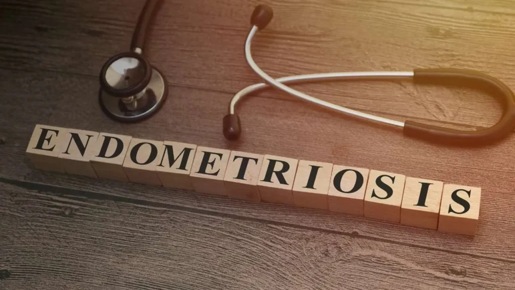 Síntomas de endometriosis señales que no debes ignorar