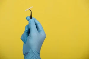 Implante Subdérmico Qué es, Síntomas y Retiro del Implanon