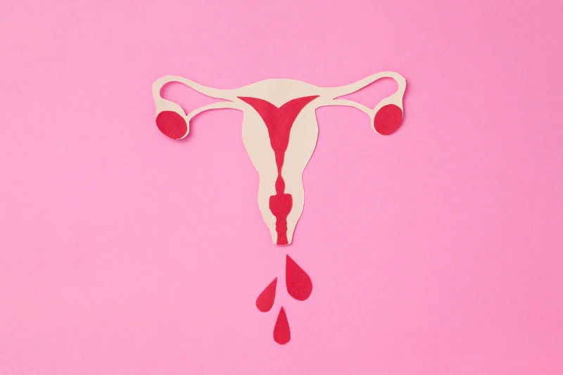 Los Síntomas de Adenomiosis Más Allá del Útero Grande