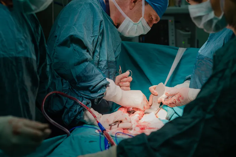 Quitando la Matriz ¿Se Quita la Endometriosis