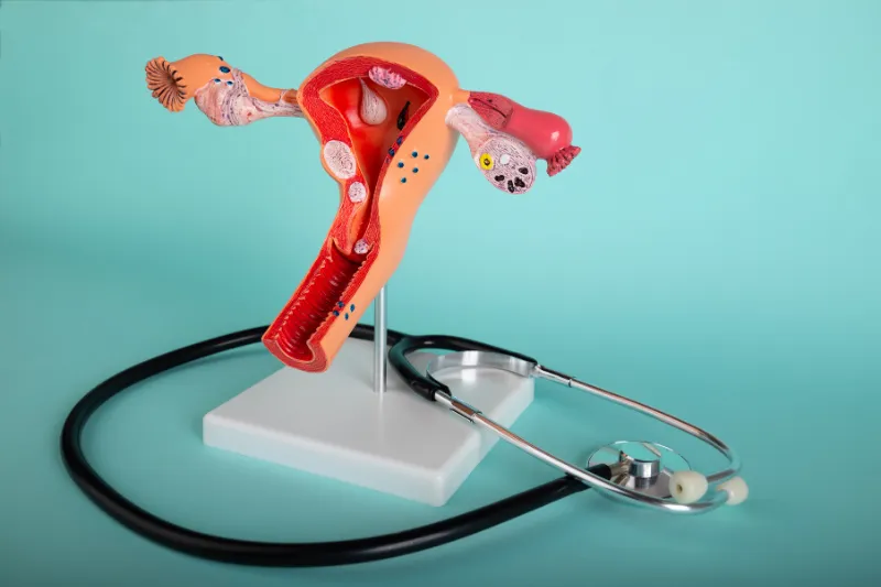 ¿Por Qué se Inflama el Endometrio Entendiendo el Proceso